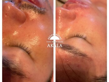 Total Beauty Salon AKALAの写真/≪本気で疲れをリセット!≫「強もみ」で満足度を追求する本格派サロン★男性歓迎◎