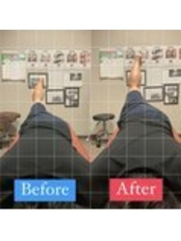 ナオル整体 宮崎院(NAORU整体)/30代男性施術事例【腰痛改善】