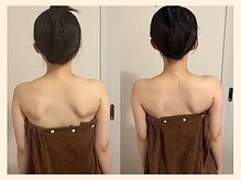 【肩こり/リンパマッサージ/小顔/ヘッドスパ】肩甲骨はがし肩こり整体RUFFREE高尾院/肩こり改善に肩甲骨はがし