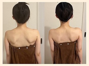 【肩こり/リンパマッサージ/小顔/ヘッドスパ】肩甲骨はがし肩こり整体RUFFREE高尾院/肩こり改善に肩甲骨はがし