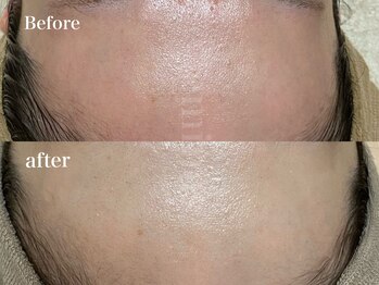 エミナス(EMINAS)/鎮静No.1