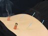 鍼灸施術　 30分　4000円