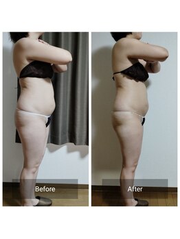 スリール(sourire)/ビフォーアフター