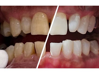 ハモットホワイト(Hamotto White)の写真