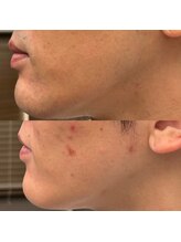 フェリーバ(FELIVA)/Before&After