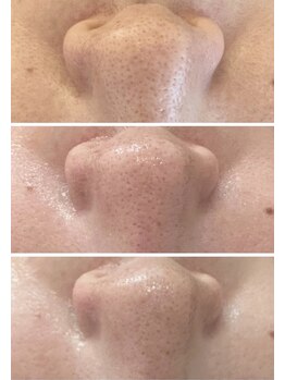 イノエ(inoe)/【汚れを弾き飛ばし、引き締め】