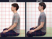さいとう治療院 新百合ヶ丘/ストレートネック・スマホ首