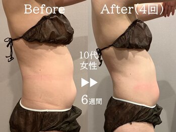 ルナステラ 七尾店/サーモシェイプDEEP