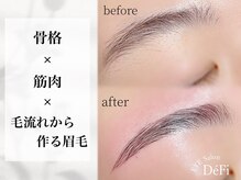 デフィ(DeFi)