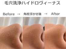 エスポワール(espoir)