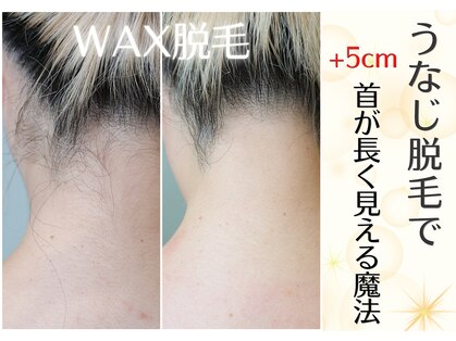 レヴィート(Revept)の写真