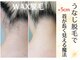 レヴィート(Revept)の写真