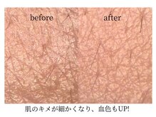 子連れエステサロン Lien【リアン】