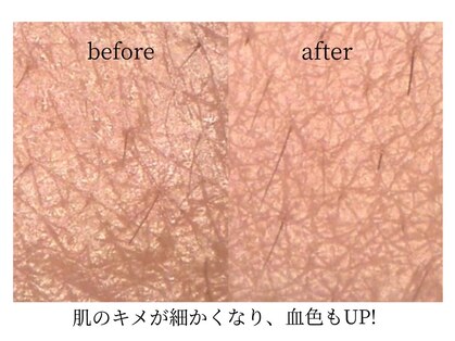 子連れエステサロン Lien【リアン】の写真