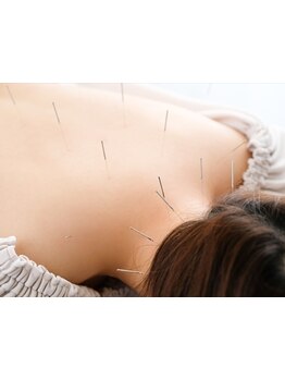 鍼灸施術を受けたい