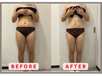 RHB東戸塚/痩身エステはRHB東戸塚