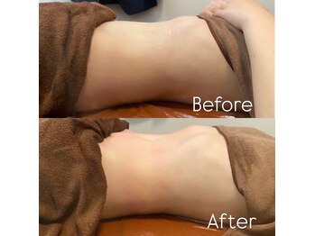 スリーズララ(Cerise LaLa)