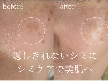 ユウドット(yuu.)の写真