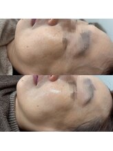 トゥインクル(Twinkle)/最強のコンビ！ララ×リフト