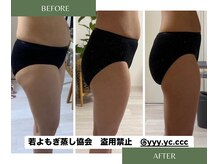 凛/若よもぎ蒸し　Before/After