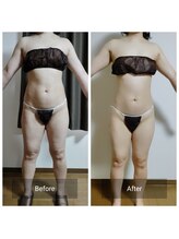 スリール(sourire)/ビフォーアフター