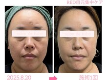 サロン ド 花歩 松山本店/目元の悩みも集中改善！