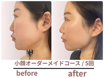 サボラミ(sabor A Mi)/小顔オーダーメイドコース