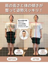 スペックフィジカルコンディショニング(SPECフィジカルコンディショニング)/30代女性/姿勢ビフォーアフター