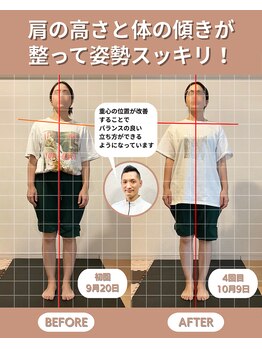 スペックフィジカルコンディショニング(SPECフィジカルコンディショニング)/30代女性/姿勢ビフォーアフター