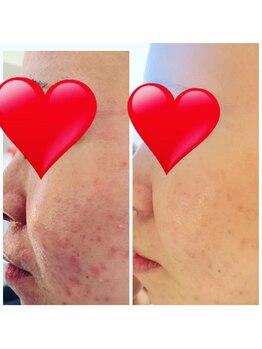 クラッシー 本八幡(CLASSY+)/自宅ケアアドバイス