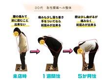 ストレッチ 整体 ホープ(HOPE)/姿勢矯正で腰痛改善
