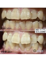 ビーバイビー(BBYB)/初回トライアルの実例♪