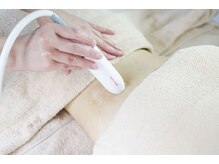 ミニョン(mignon)/