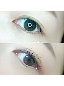 サロン エフ(salonF)/ビフォーアフター♪