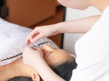 プラチナサロン 六本木の写真/美容鍼が初めて&気になる方に!プロによる鍼施術でリフトアップが叶う♪全身を整える脚鍼、ハーブティー付◎