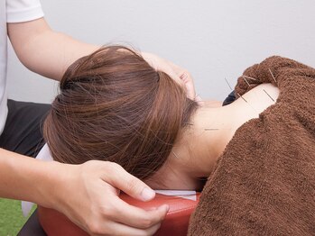 あかりはり灸整体院 鈴鹿/頸部、肩の鍼施術