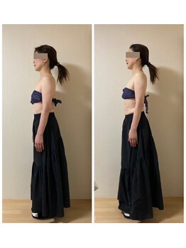 シャンタイン(SANTAI)/姿勢改善★モンテセラピー