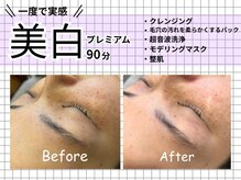 プロッソル こころ(PROSOL)