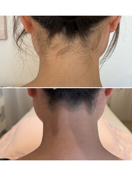 シュク(SHUKU)/うなじデザイン