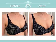 美人バスト 浜松店/◇ バストアップ &nbsp;BeforeAfter◇