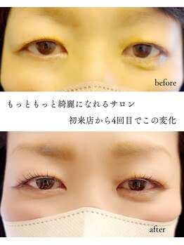 グロウビューティー(grow beauty)/