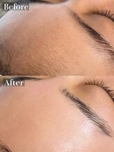 ラナ(Lana)/白玉フェイシャルワックス脱毛