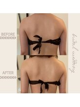 ラ フルール/痩身コース