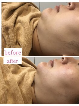 エスビーエス トウキョウ 錦糸町店(SBS TOKYO)/