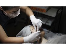 ハリQ治療院 麻布十番の雰囲気（健美鍼（美容鍼）／リフトアップ・美肌）