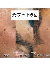 ラウラウ(laulau)/光フォト