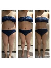 サロン ド スー(Salon de Suu)/ウルトラ全身