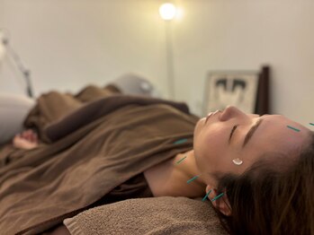 藤江鍼灸の写真/毎日を頑張る女性に寄り添う、静かな”癒し”の鍼灸をご提供。あなたの為の第三の居場所を目指しています。