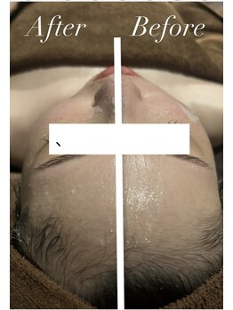 オタク(OTAKU)/大人気の最新型小顔&リフトUP♪