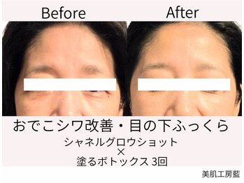 藍/シャネルグロウショットでツヤ肌